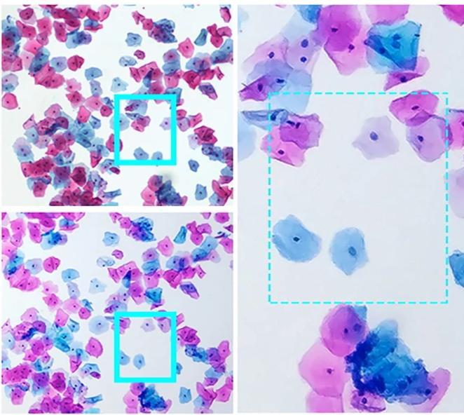 Universal Phone Microscope Adapter